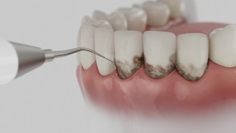 Reliable Dental contractor in Yellowstone County County, MT by Dentist Open Now